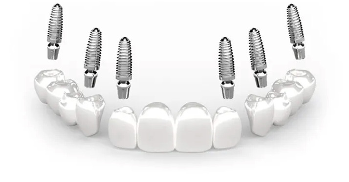 3 on 6 Dental treatment features